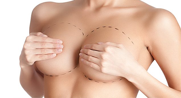 Всё, что нужно знать о пластике груди